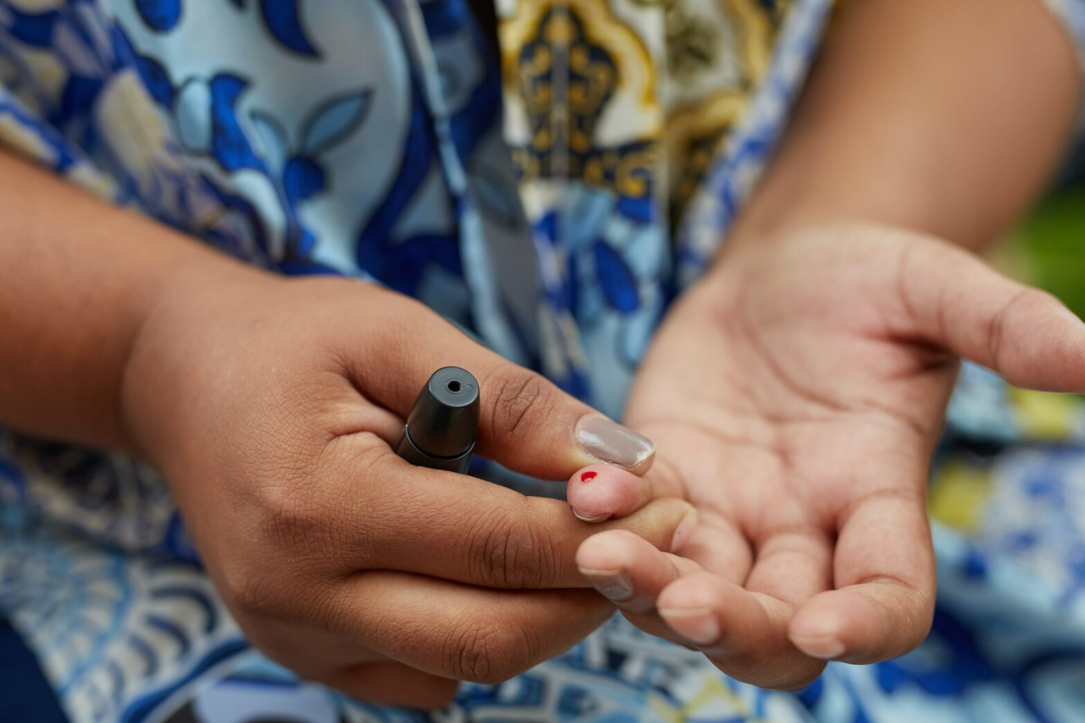 Understanding Semaglutide: A Breakthrough Treatment for Type 2 Diabetes